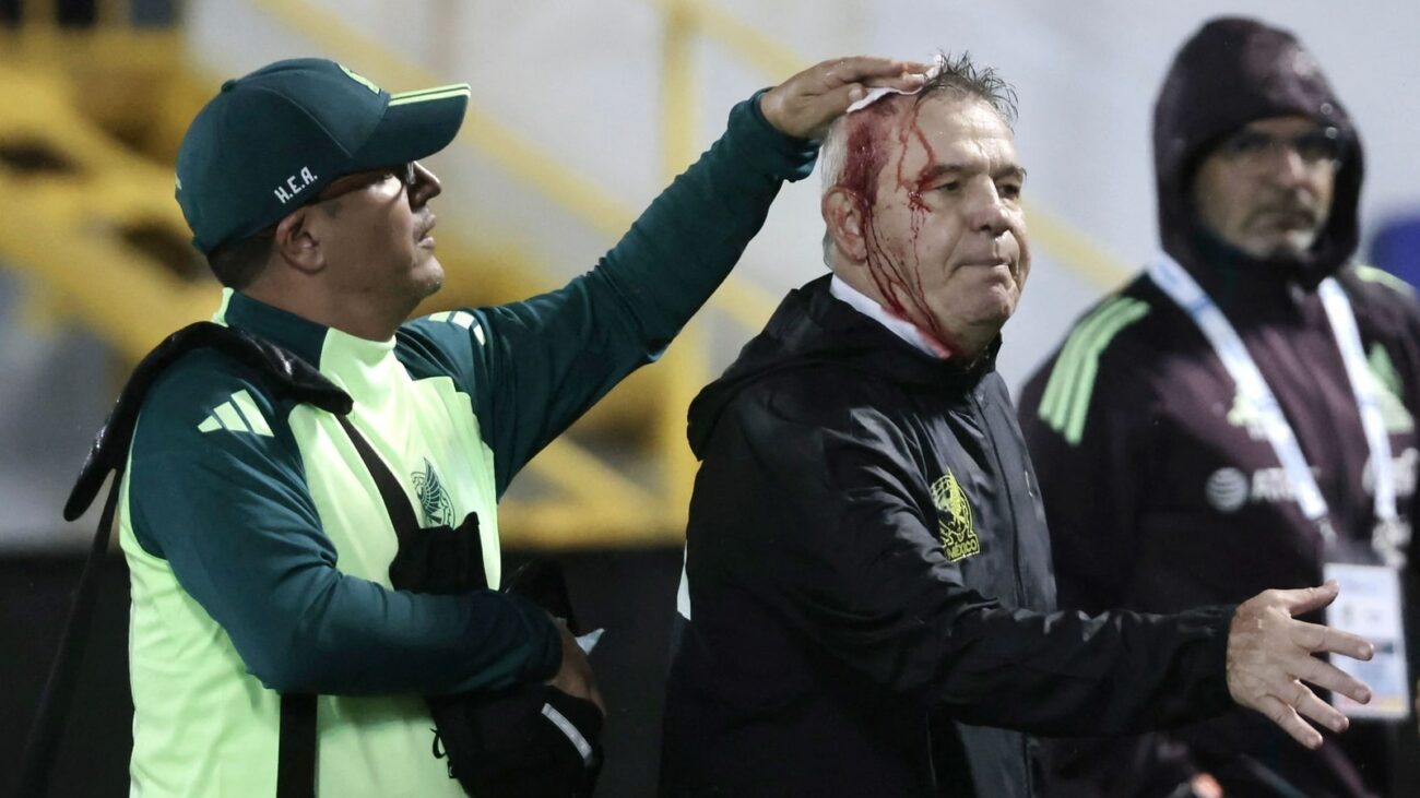 Mexico Coach Aguirre Injured in Post-Match Attack